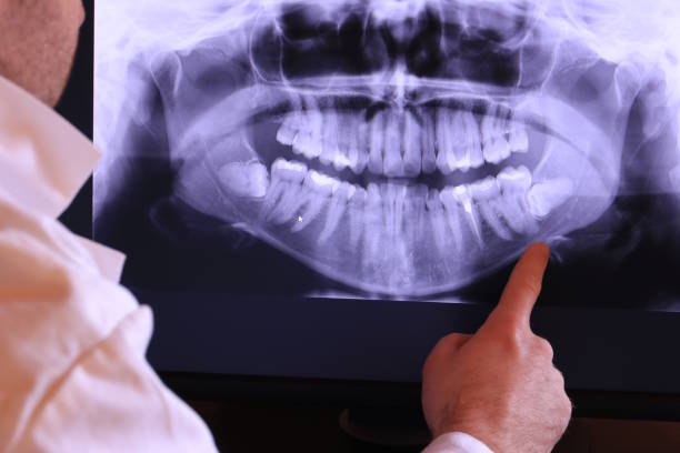 Best Pediatric Emergency Dentist in Catlin, IL